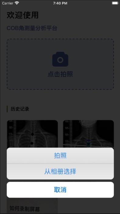 cobb角测量分析平台app下载,cobb角测量分析平台,医学app,测量app