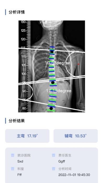 cobb角测量分析平台app下载,cobb角测量分析平台,医学app,测量app